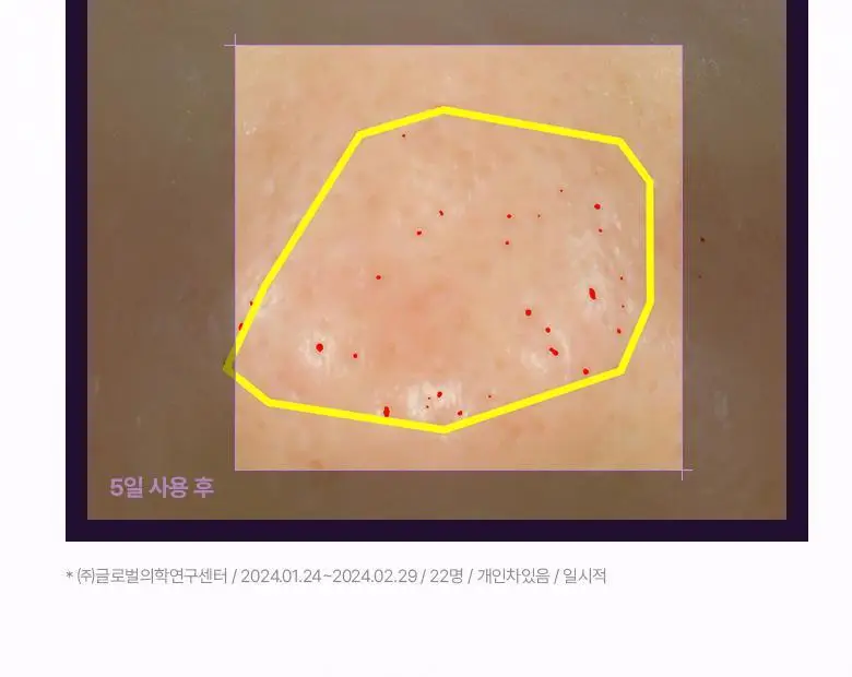 [콜라겐|모공고민] 바이오힐보 프로바이오덤 콜라겐 리모델링 세럼 30ml [증정/더블기획] 상세페이지 24